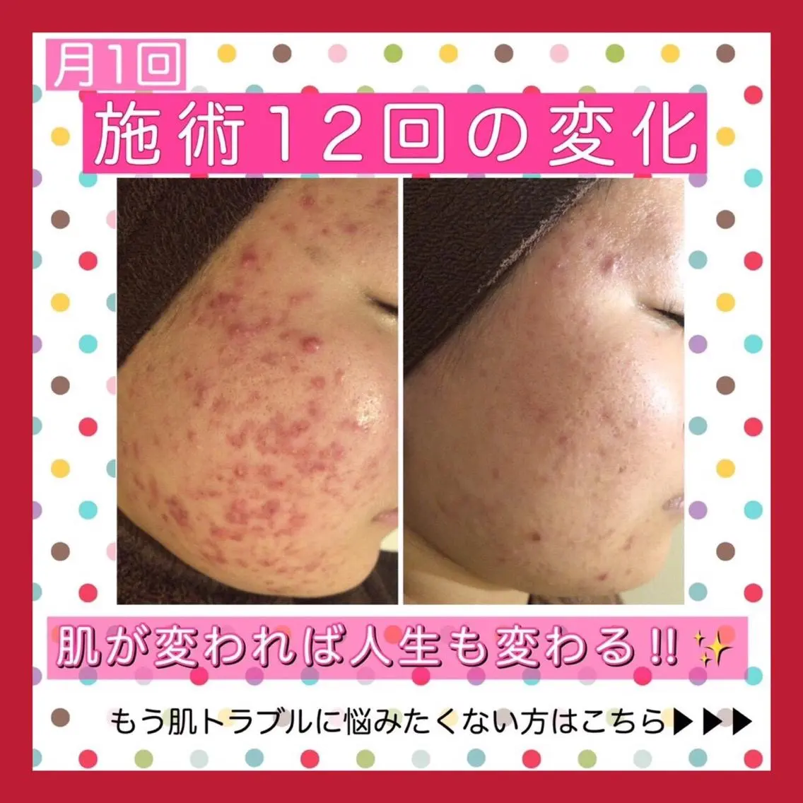 ミディアム カラー パーマ ヘアアレンジ メンズ ネイル マツエク・マツパ ニキビ・肌質改善専門 ♡人生が変わるサロンのエステ・リラクイメージ