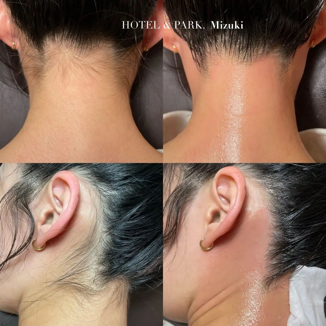 【VIO＋うなじワックス脱毛】大人の身だしなみset！の写真