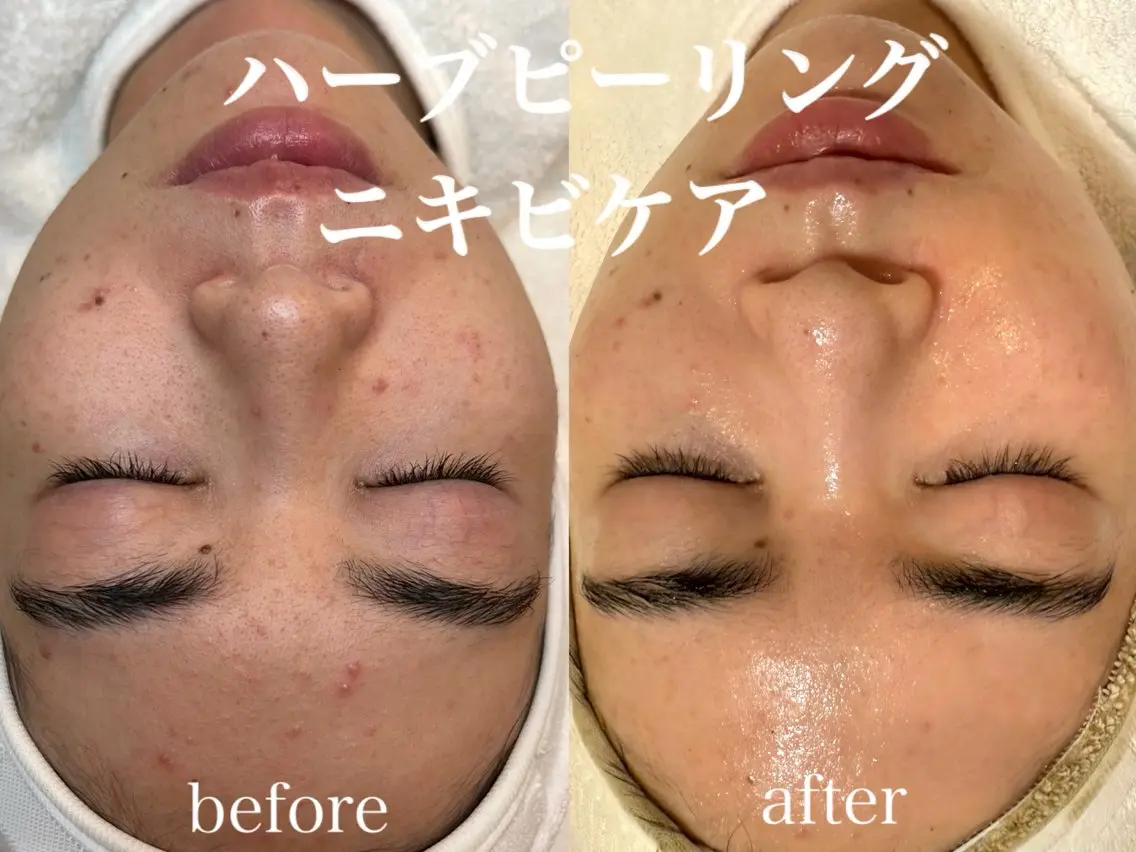肌管理サロン neoriiのその他イメージ