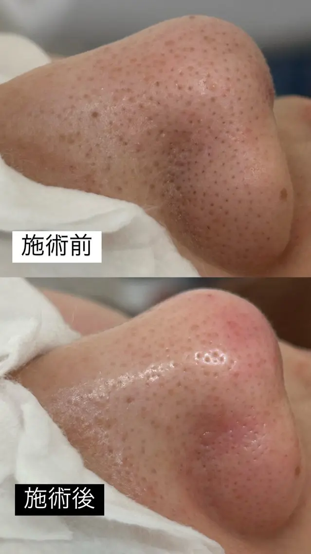 佐藤 明香のマツエク・マツパデザイン