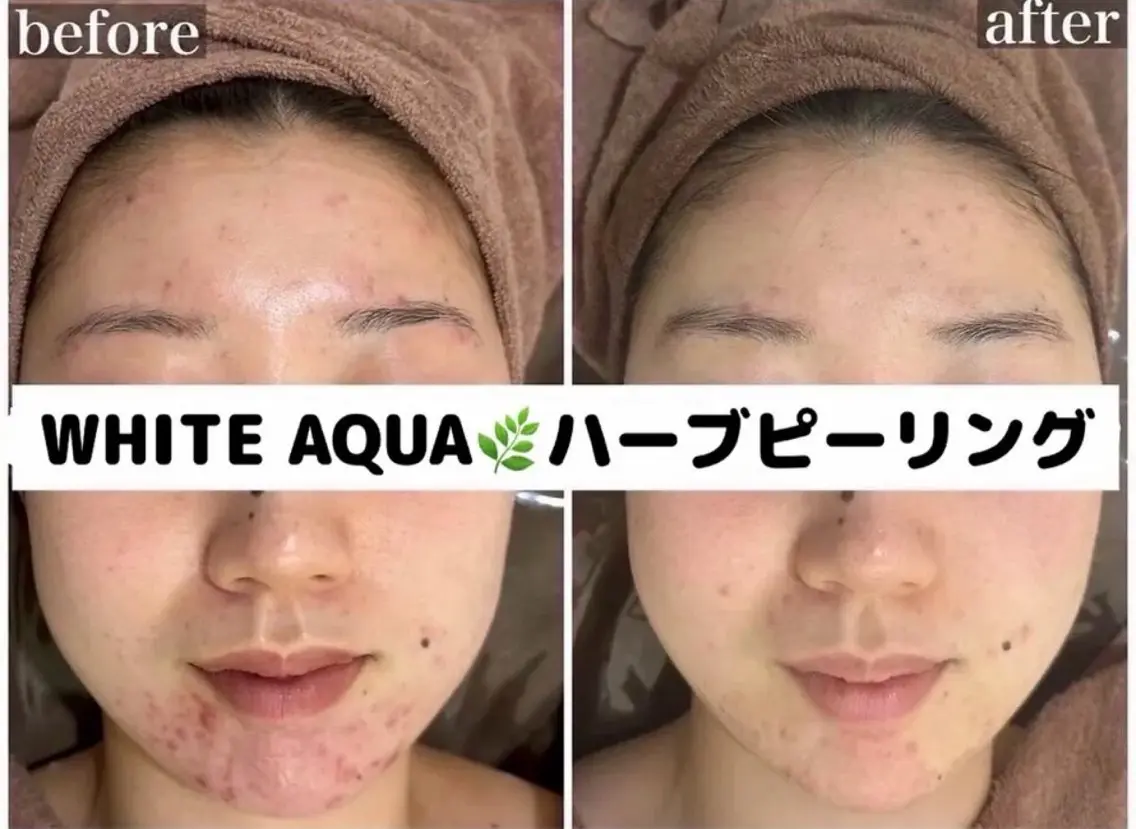 エステ WHITE AQUA 🌼柏店のエステ・リラクイメージ