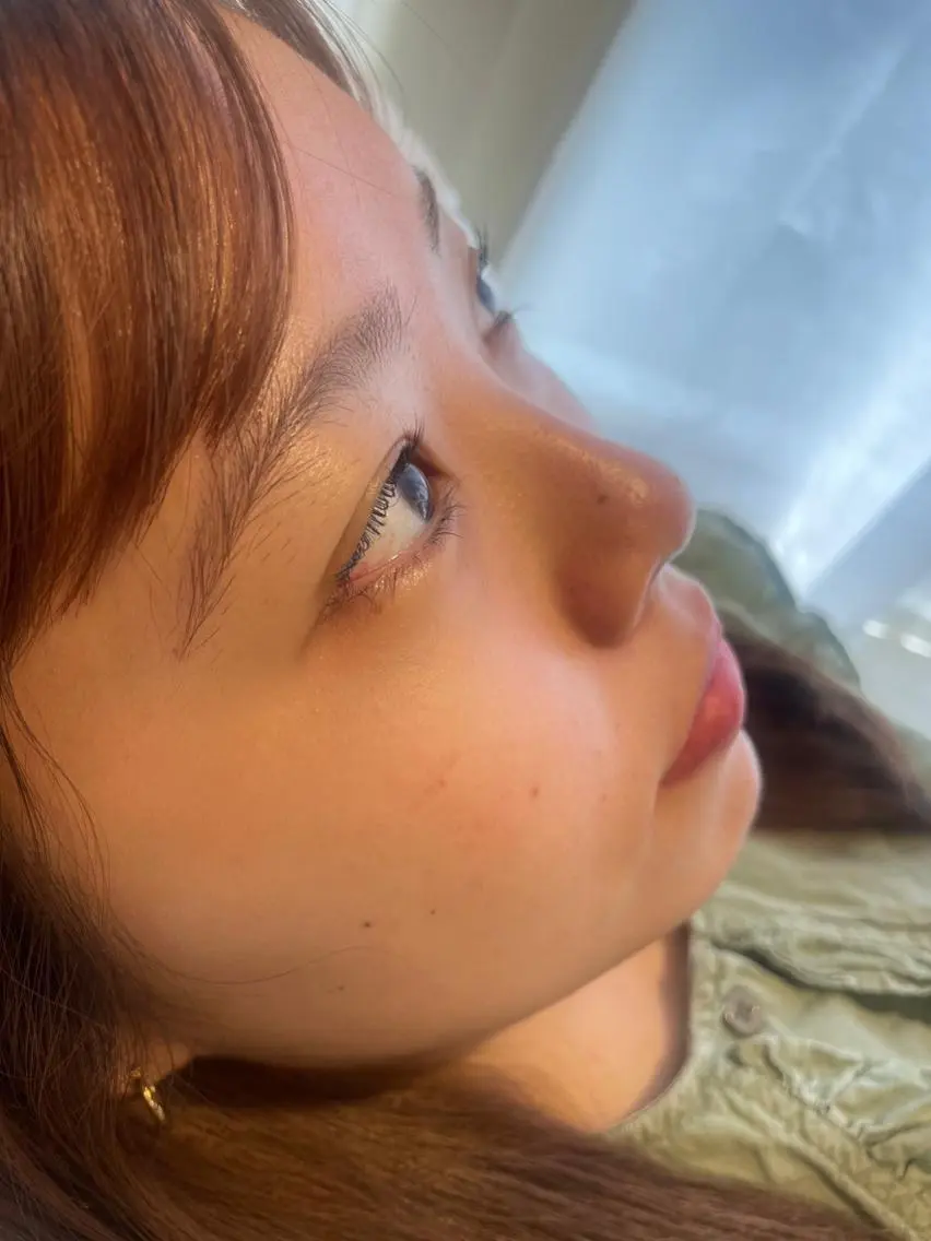 オーガニック☘️ワックス脱毛(小鼻、鼻下、鼻周り周辺+顎)10代〜20代前半限定♪施術は男性が担当します!の写真
