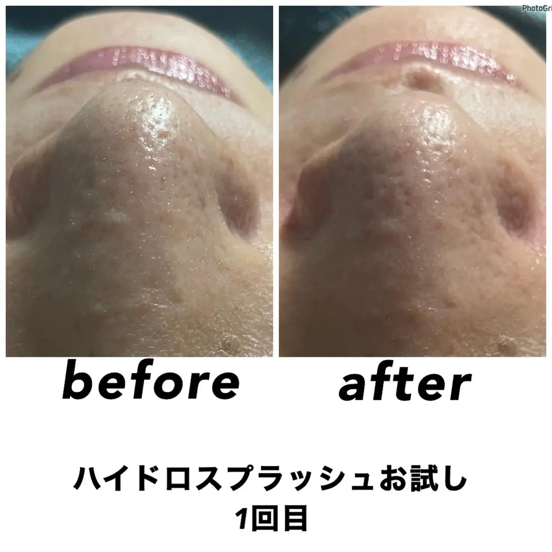 エステ リラク ネイル・エステサロン UILANIのエステ・リラクイメージ
