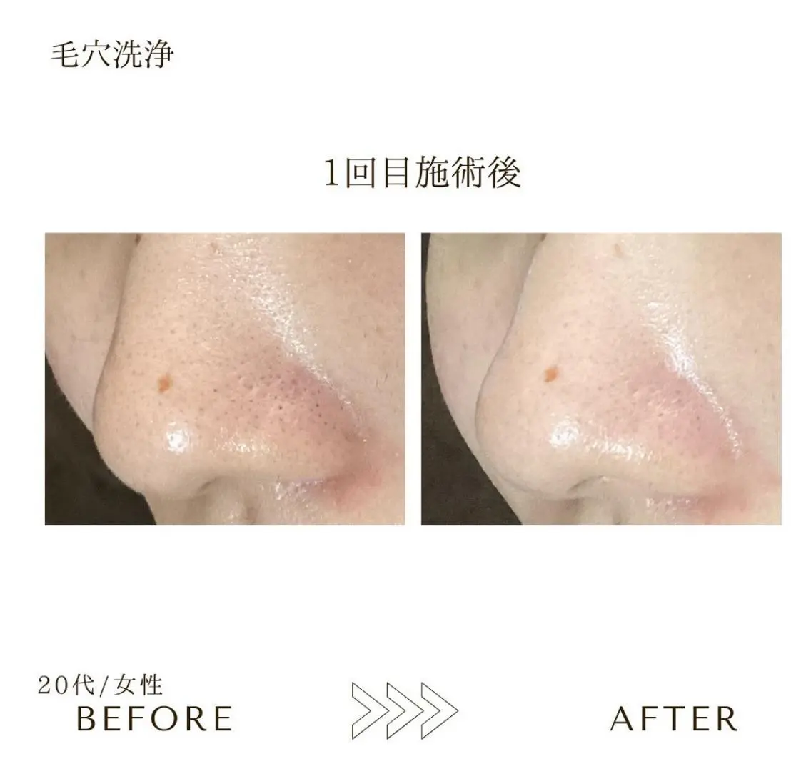 本八幡salon83 ♡エイトミーのエステ・リラクイメージ
