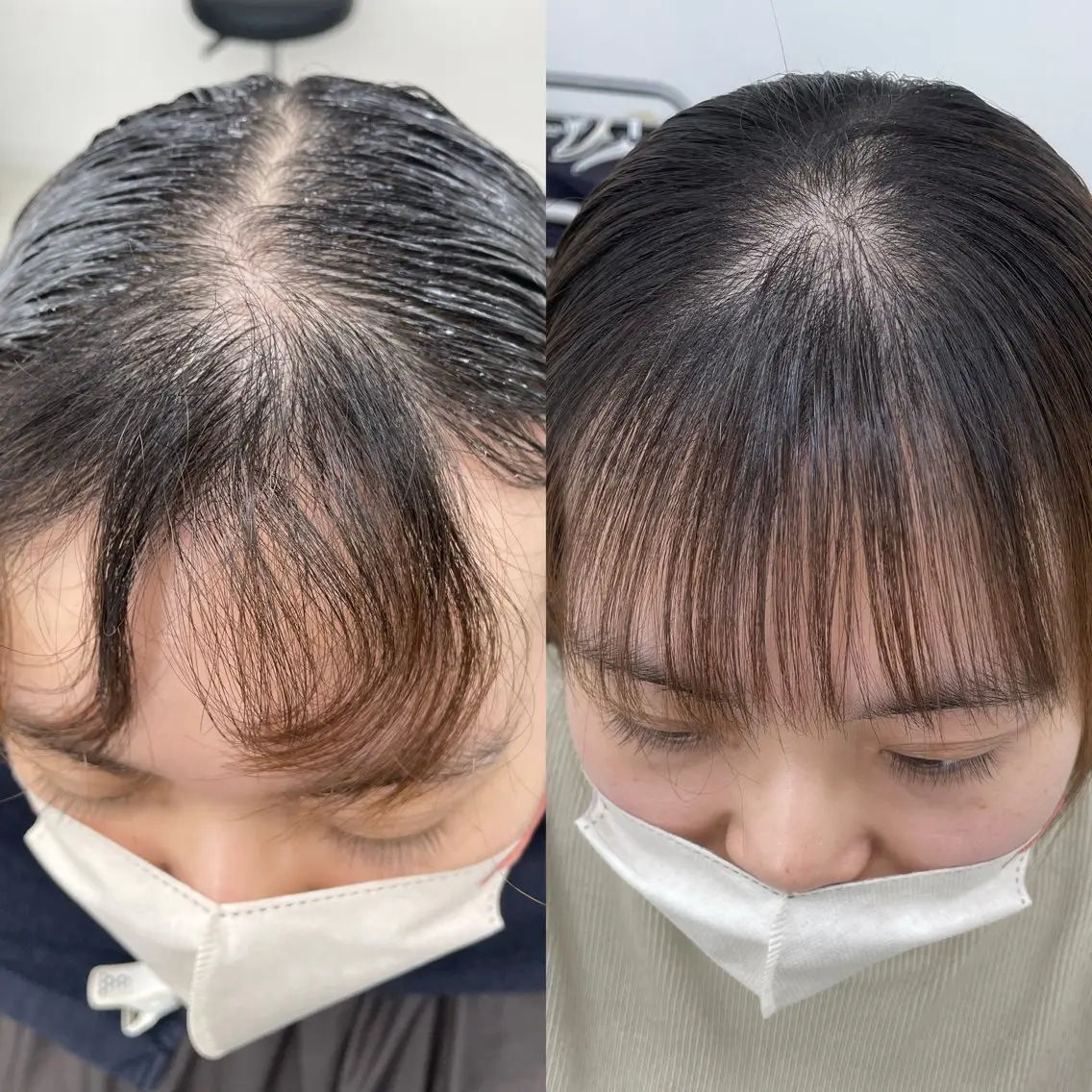 前髪顔周りカット+クロスパーマ(前髪縮毛矯正)の写真