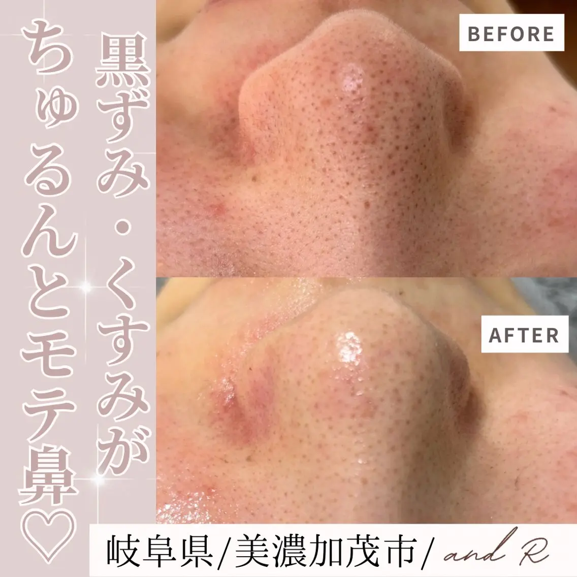 and R 男女 脱毛、毛穴サロンのエステ・リラクイメージ