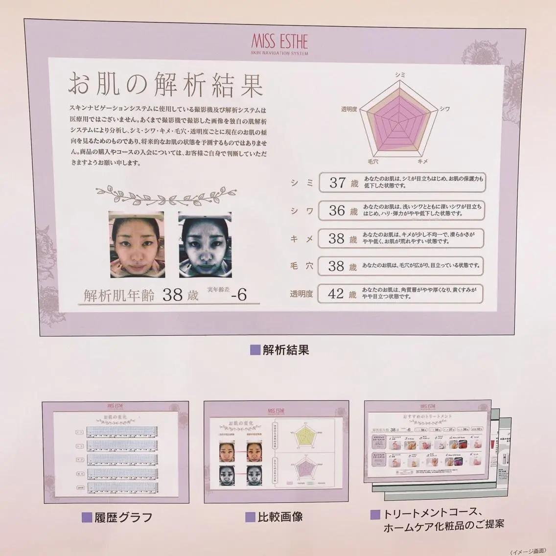 Eclat ALICEのその他イメージ