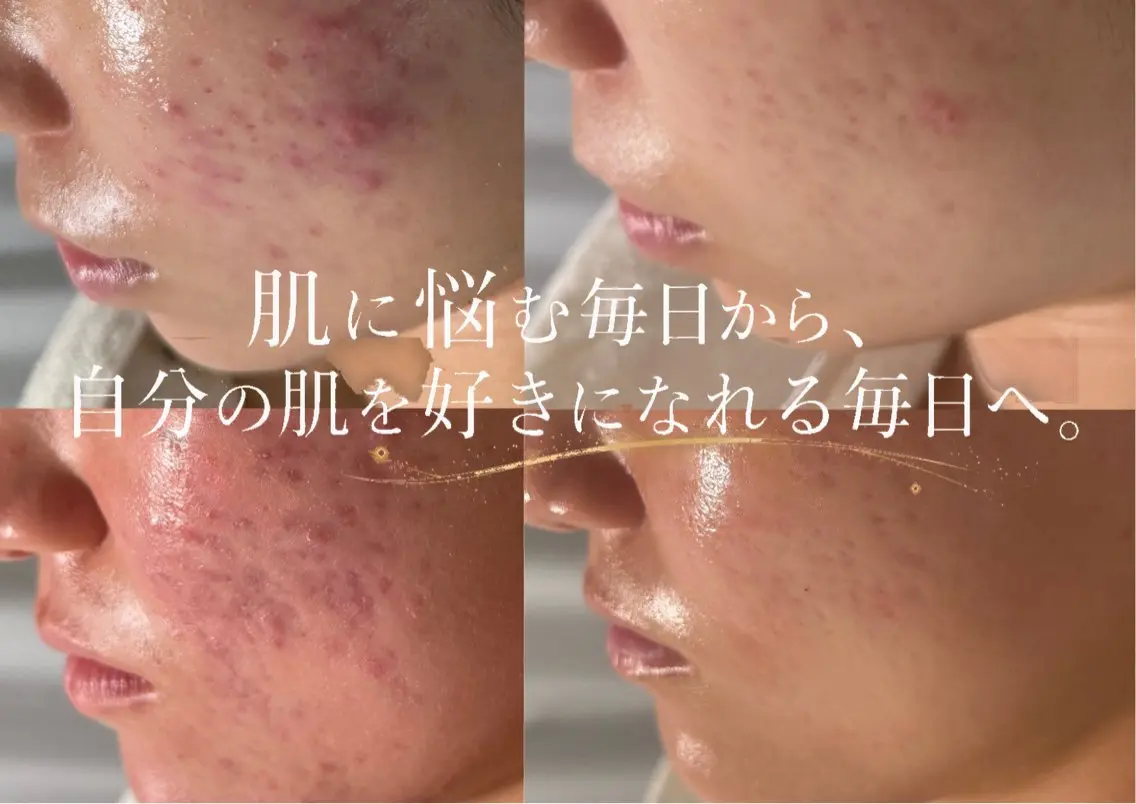 lumi riseのエステ・リラクイメージ