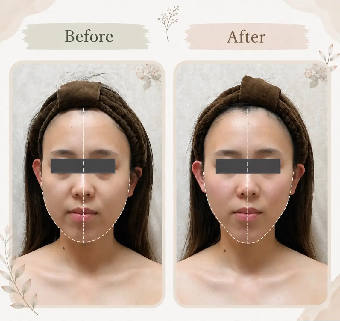 小顔 facelaboのエステ・リラクイメージ