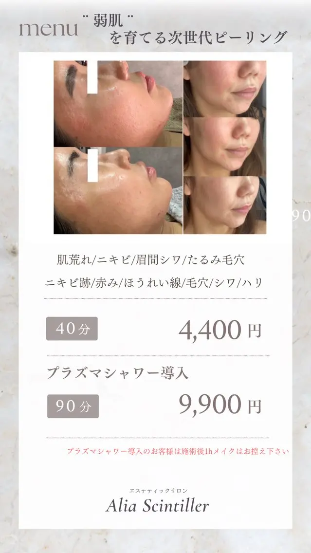 【第一印象UP】お肌揺らぎやすい方、赤み出やすい方必見！！次世代型ピーリングトリートメント👼の写真