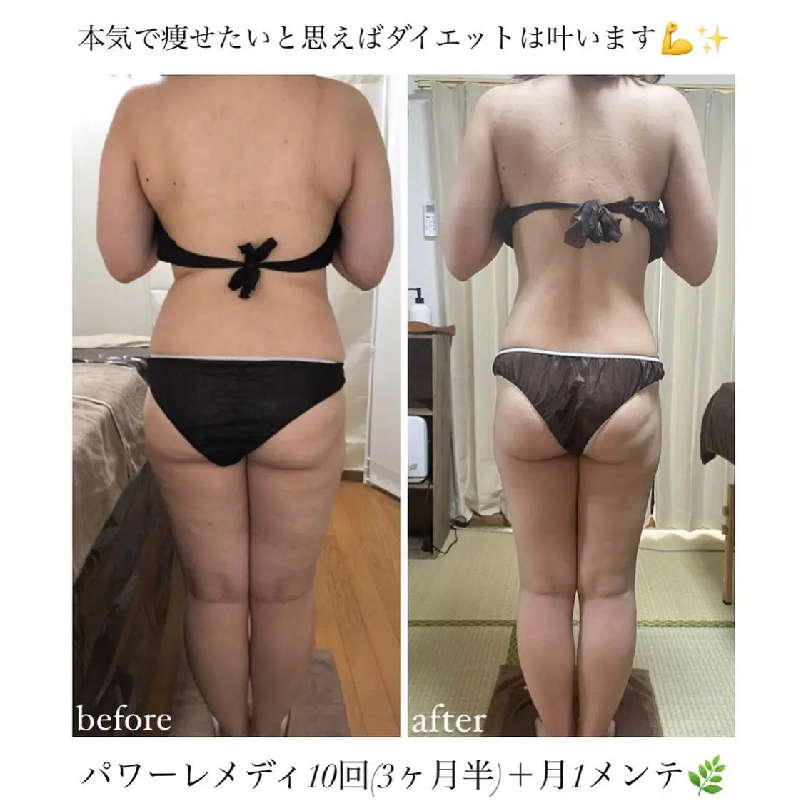 《本気痩せ×疲労改善 》 BILOOPのエステ・リラクイメージ