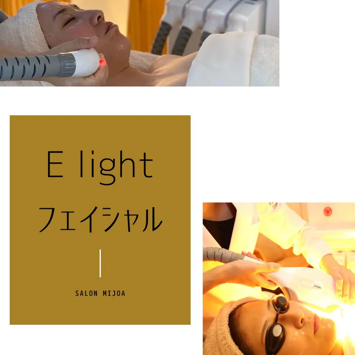 E lightフェイシャルの写真