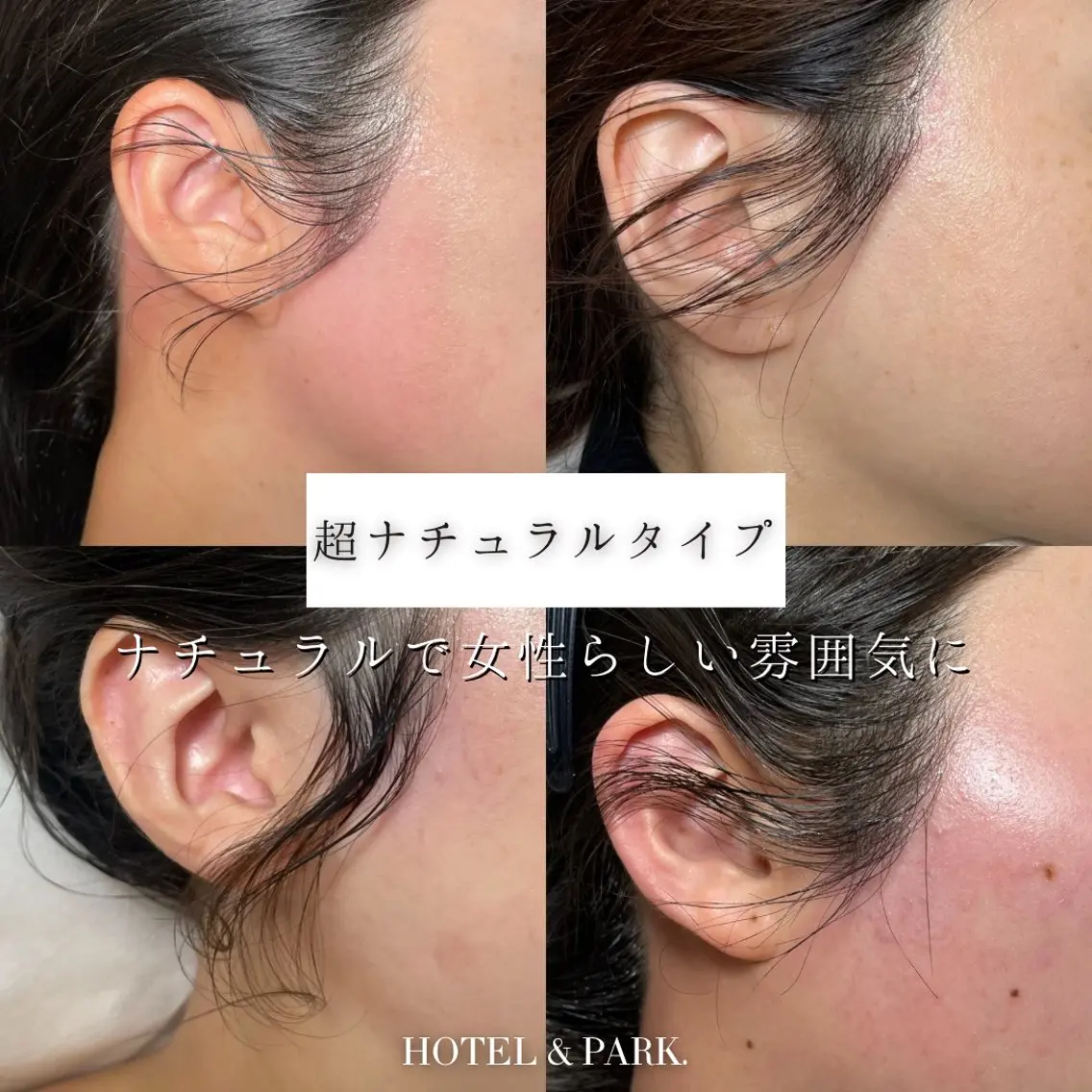 脱毛 HOTEL&PARK . ワックス脱毛のエステ・リラクイメージ
