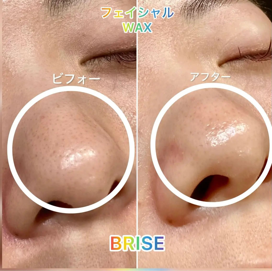 エステ BRISE ブライズのエステ・リラクイメージ