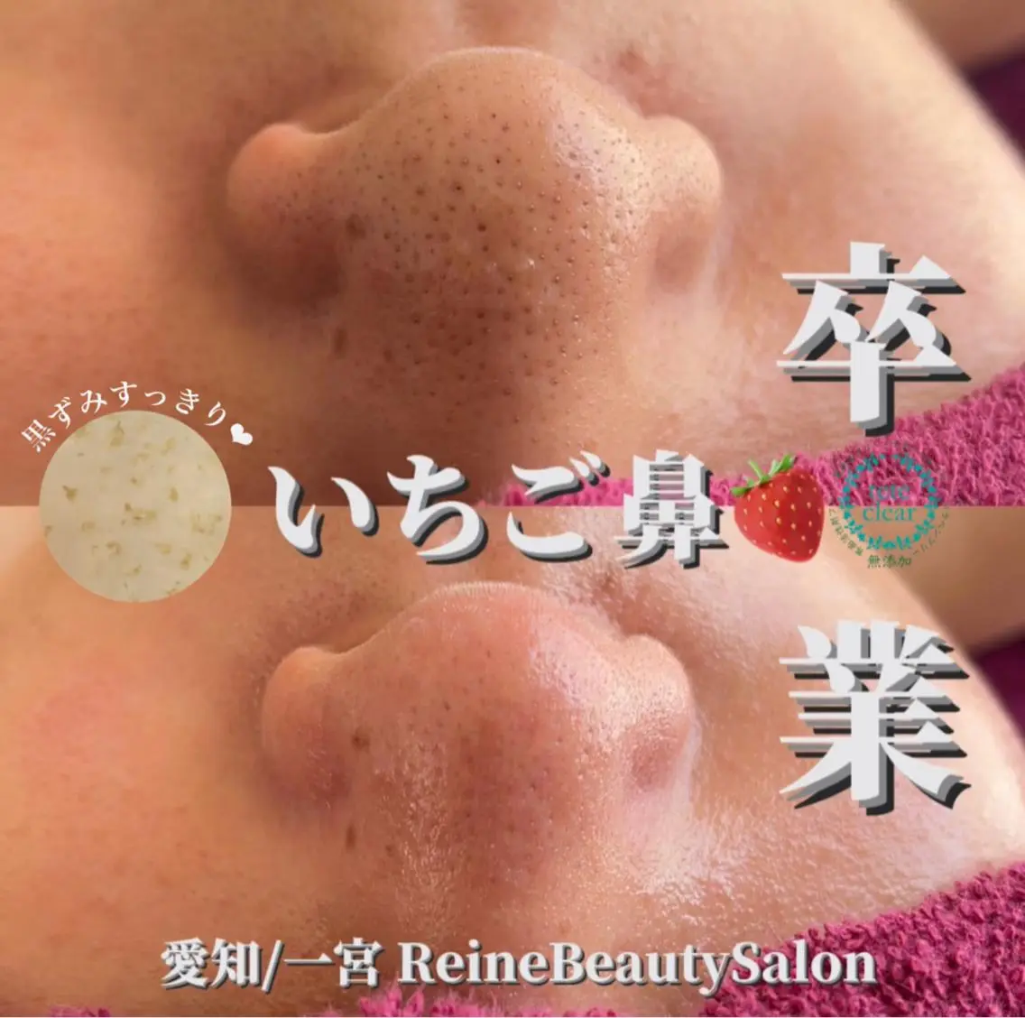 毛穴/シミ肝斑/脱毛 横山梨里のエステ・リラクイメージ
