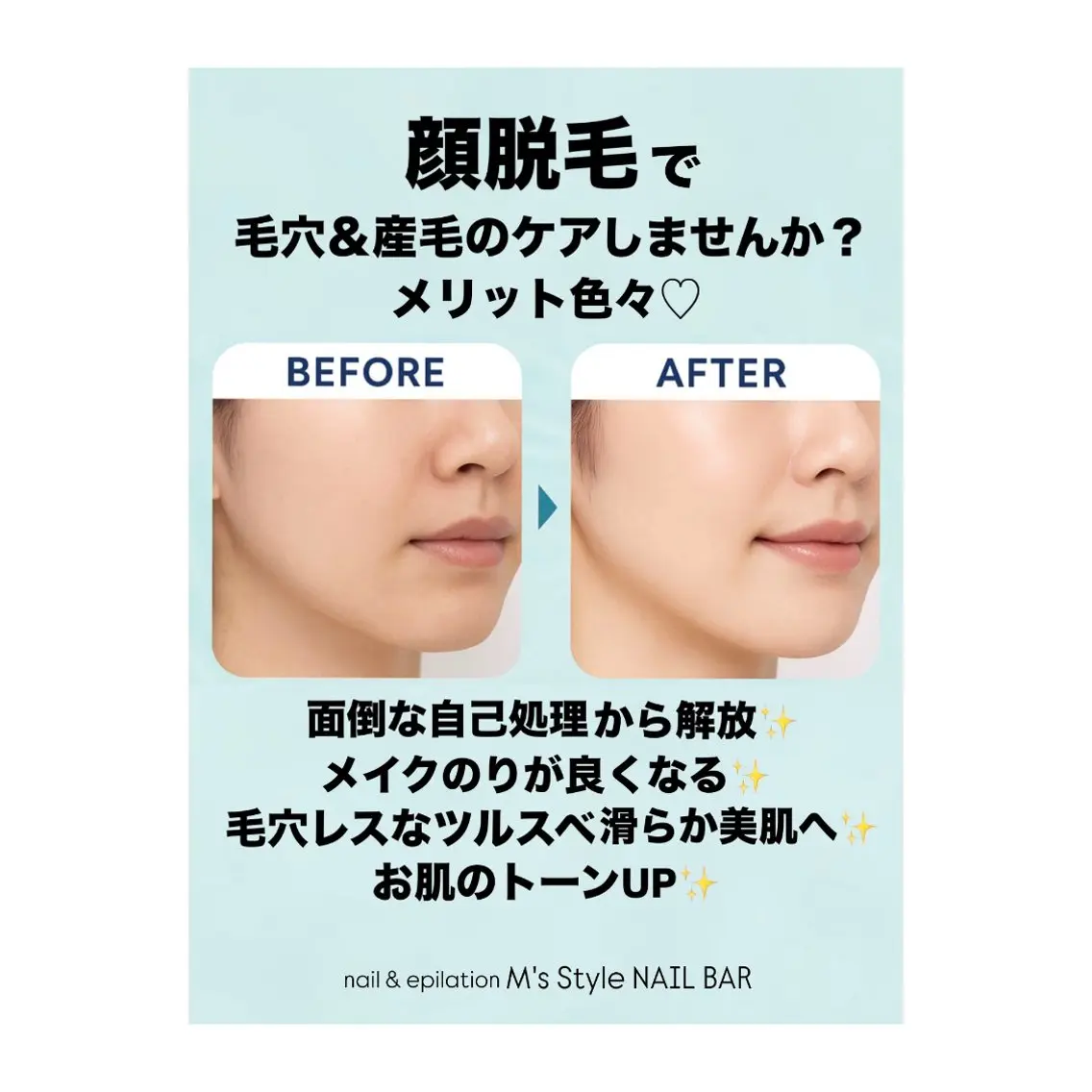 脱毛 M's Style NAIL BARのネイルデザイン