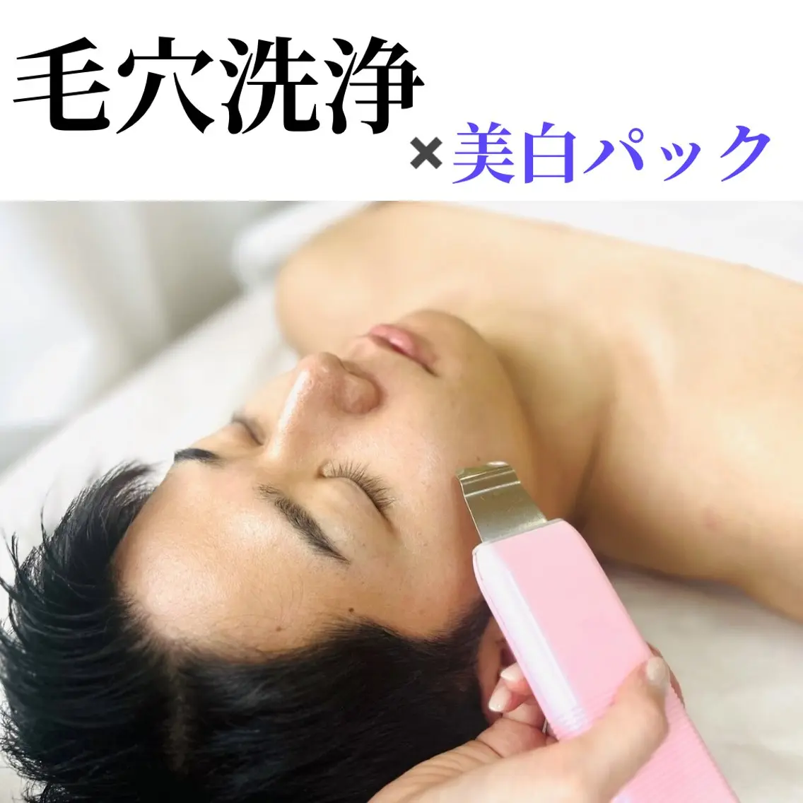 【 毛穴洗浄×美白パック 】お手軽に毛穴の大掃除+美白ケアを🫧エステデビューの方にもオススメ ◎ ¥3,980の写真