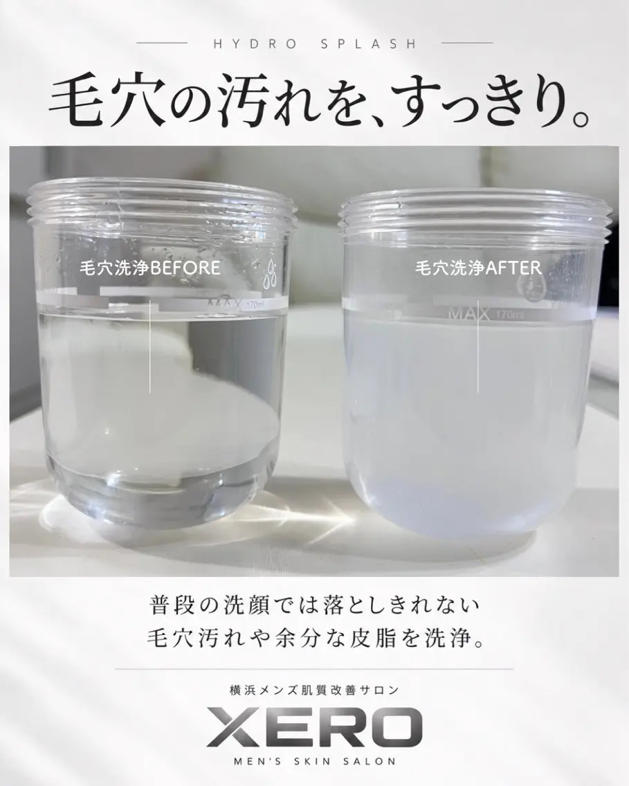メンズ メンズ特化肌質改善 XEROのエステ・リラクイメージ