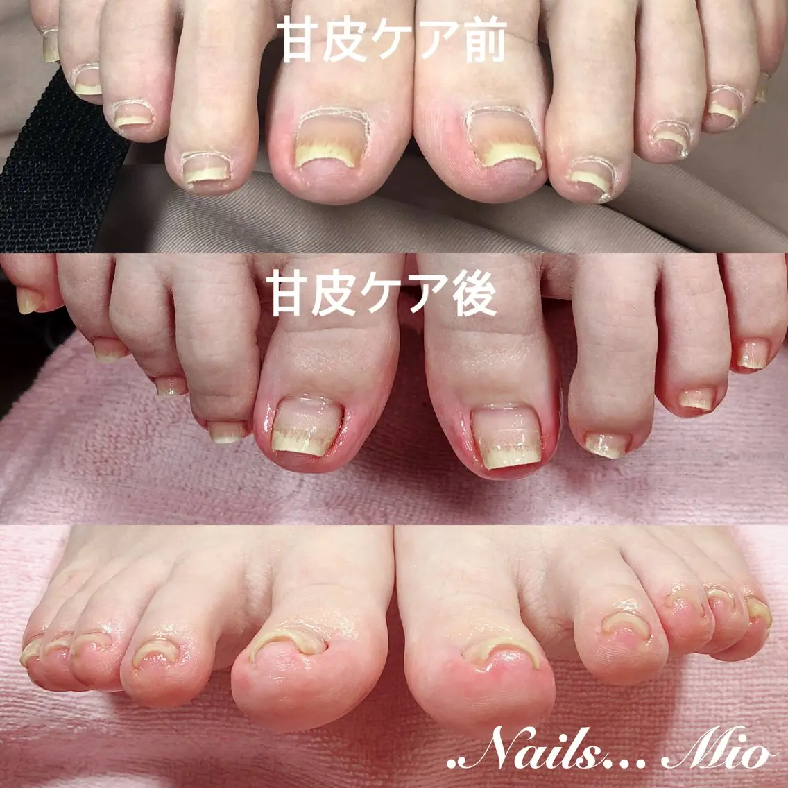 ネイル フットネイル ジェルネイル 赤色 フットネイル .Nails Mio 赤羽西ネイルサロンのネイルデザイン