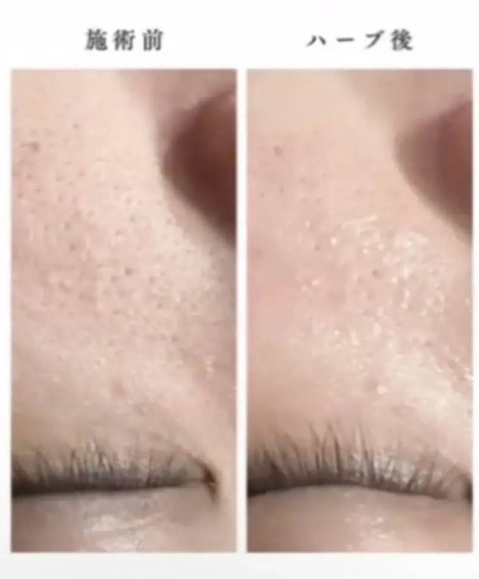 エステ esthesalon O'-en-のエステ・リラクイメージ