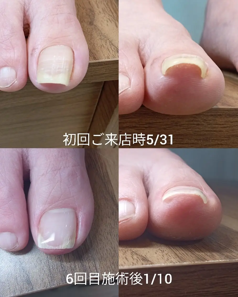 ネイル フットネイル 【まみ】 Ka Pilinaのネイルデザイン
