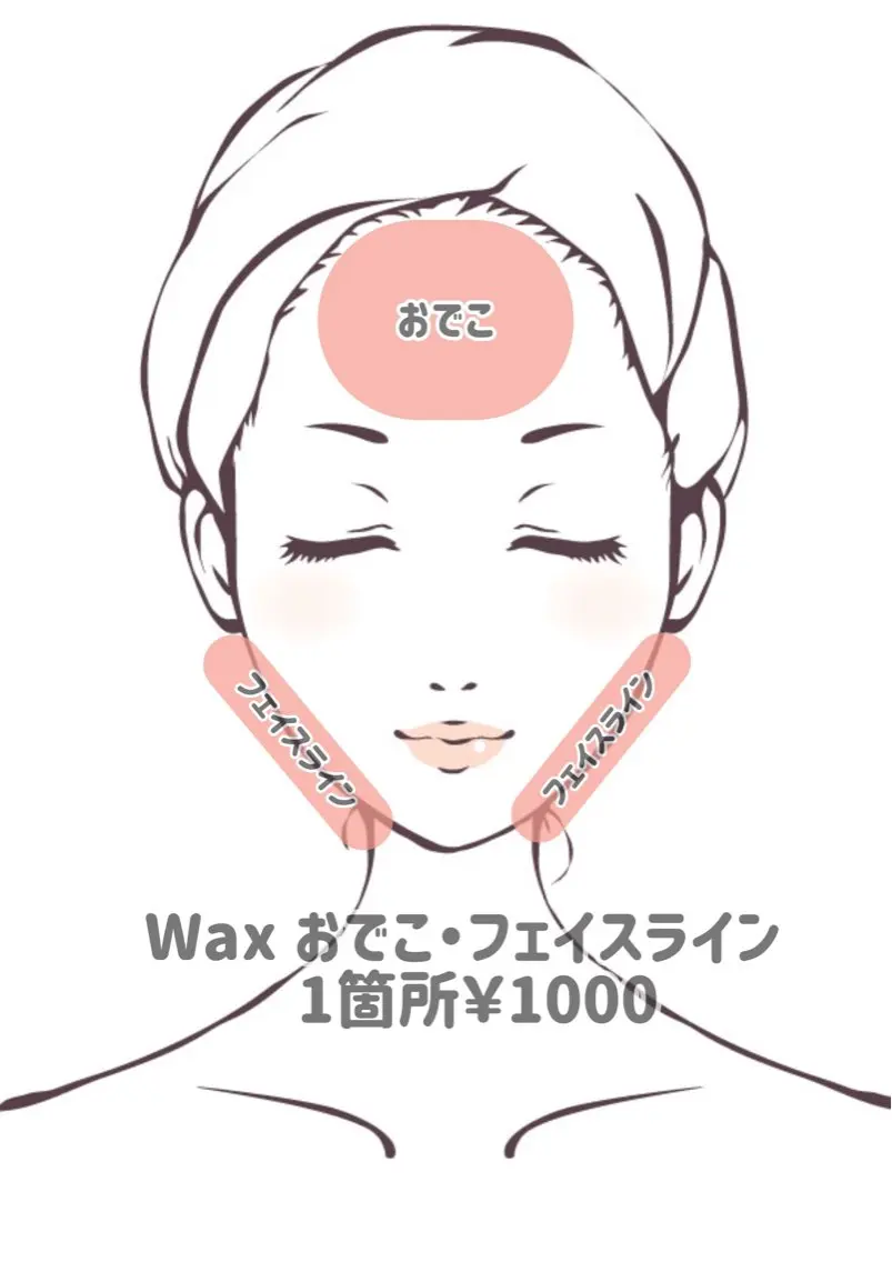 【Wax脱毛】おでこ・フェイスライン ♡各￥1000の写真
