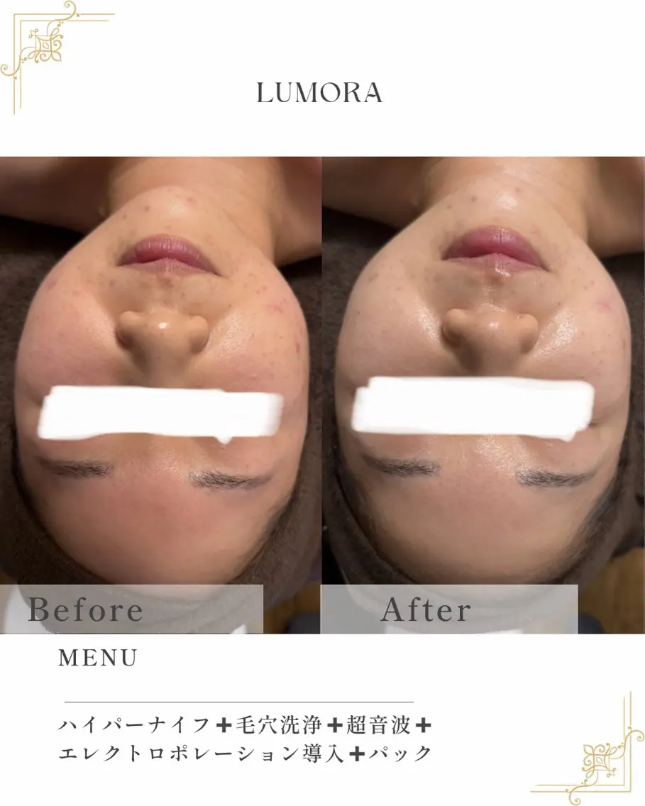 LUMORA🌟 トータルビューティーのエステ・リラクイメージ