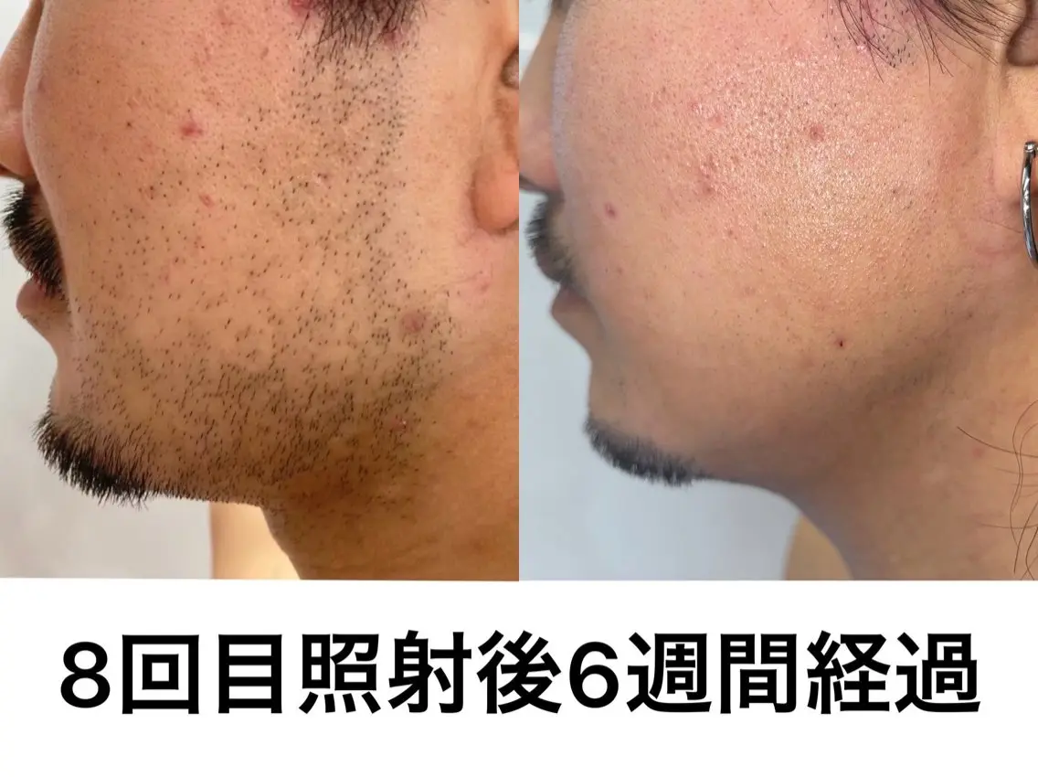 メンズ H.beau＋ 岩切 優華の眉毛・アイブロウイメージ