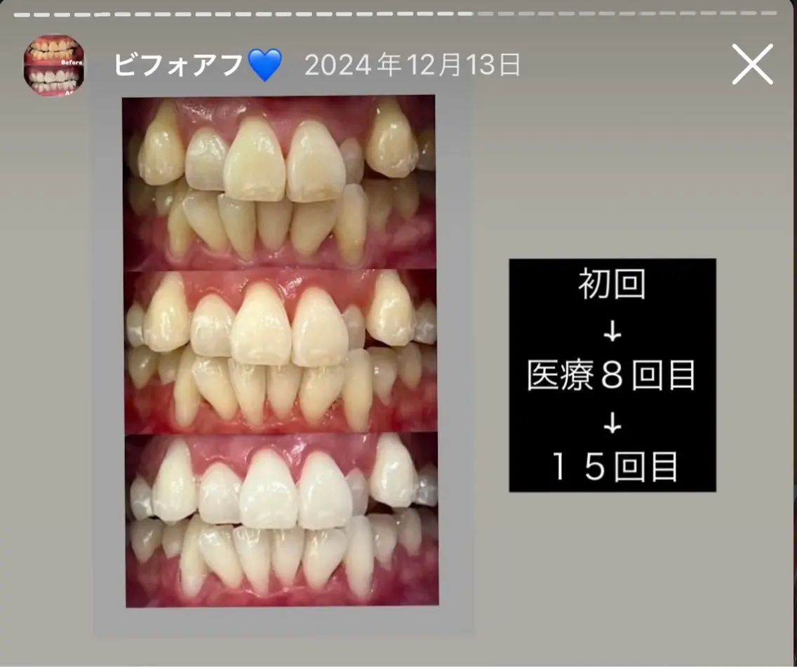 Kaula ホワイトニング🦷✨のエステ・リラクイメージ
