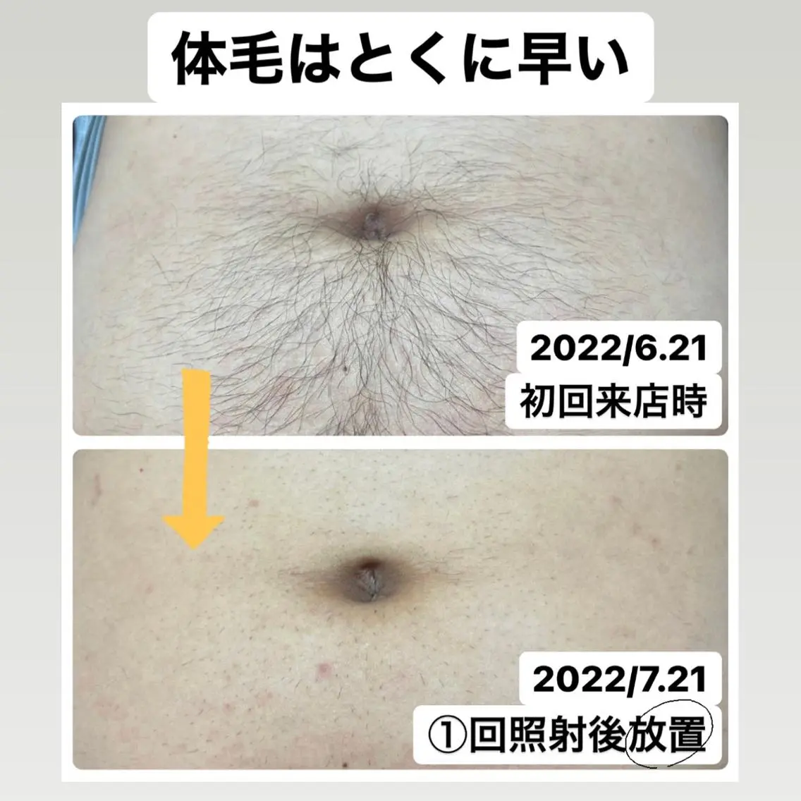 メンズ メンズハイライト 脱毛 メンズ脱毛サロン Le falcoのエステ・リラクイメージ