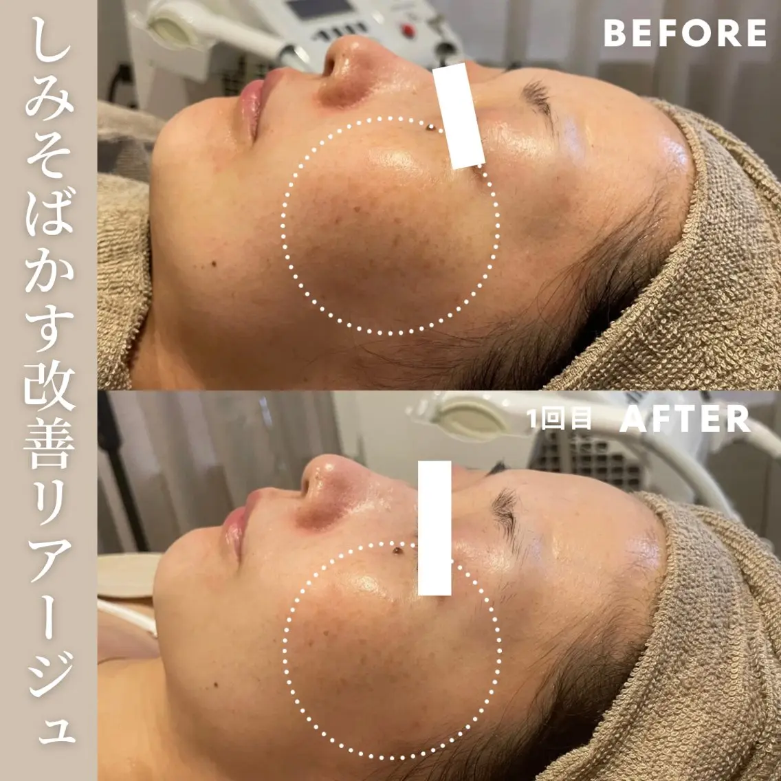 エステ Lassy Yuriの眉毛・アイブロウイメージ