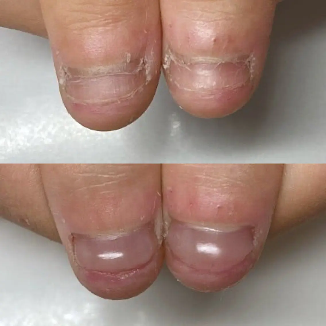 ネイル ネイルサロン アリュームのネイルデザイン