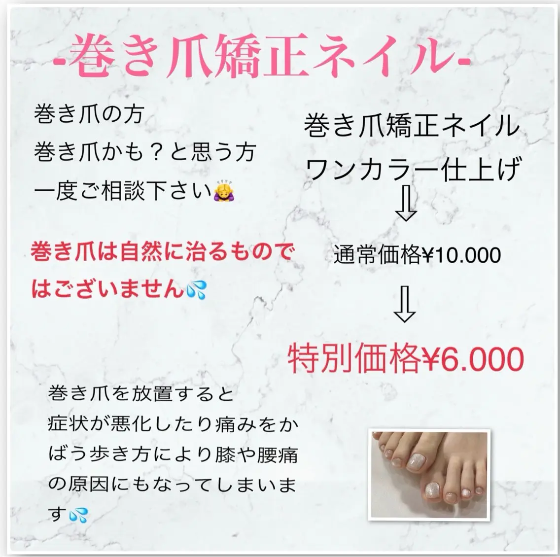 ネイル フットネイル Nail ecxia ／Reikaのネイルデザイン