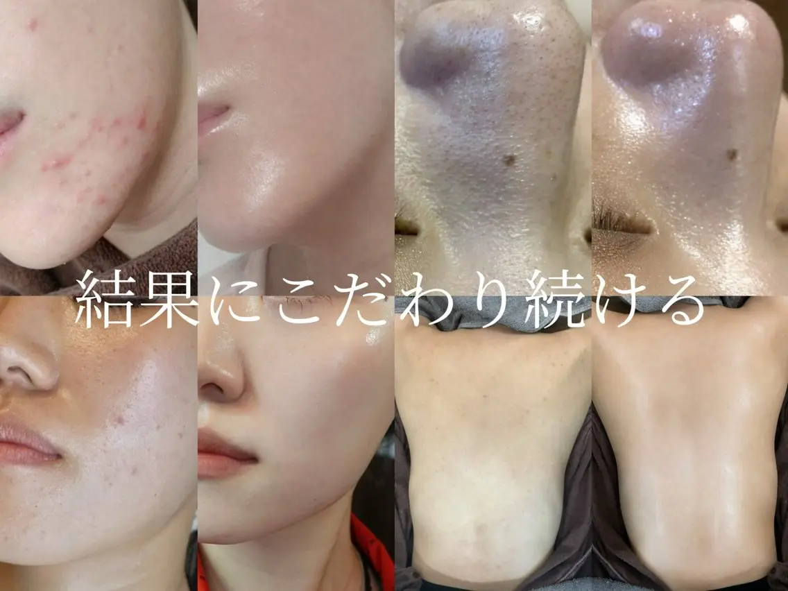 エステ 艶肌デトックス🫧 Samiraのエステ・リラクイメージ