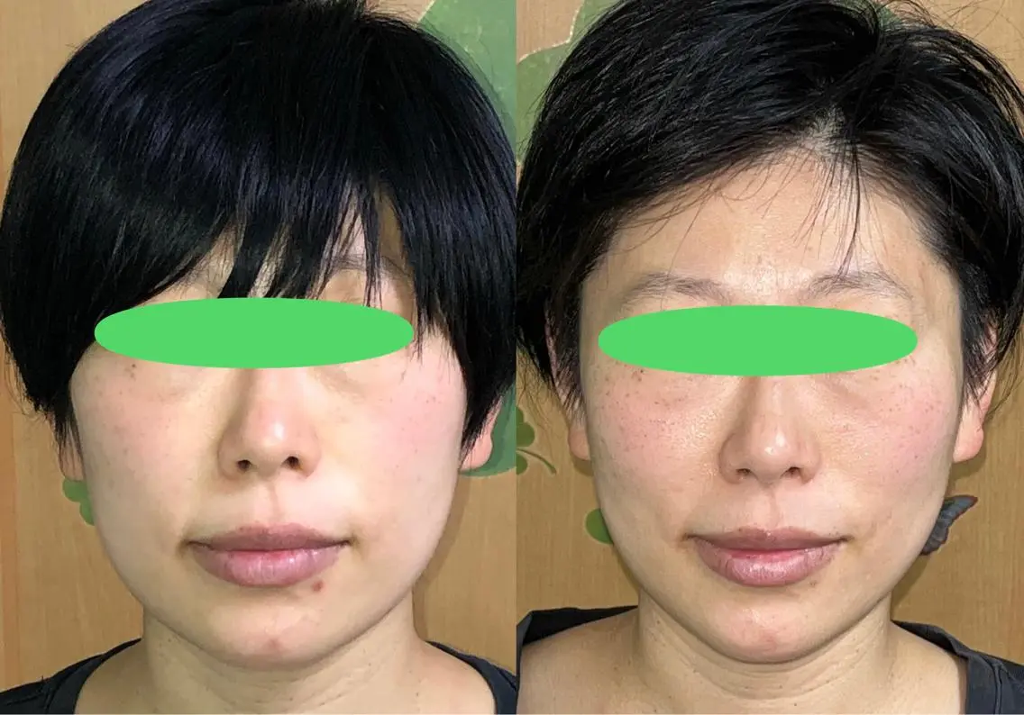 エステ リラク 春日井トータルからだ サロンふくふくのエステ・リラクイメージ