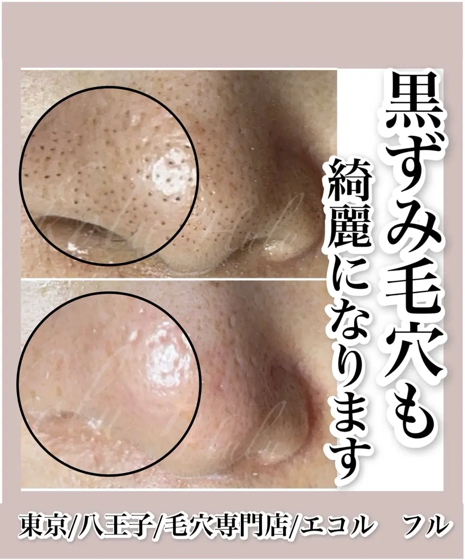 ツヤ肌・美肌サロン (エコル フル)のエステ・リラクイメージ