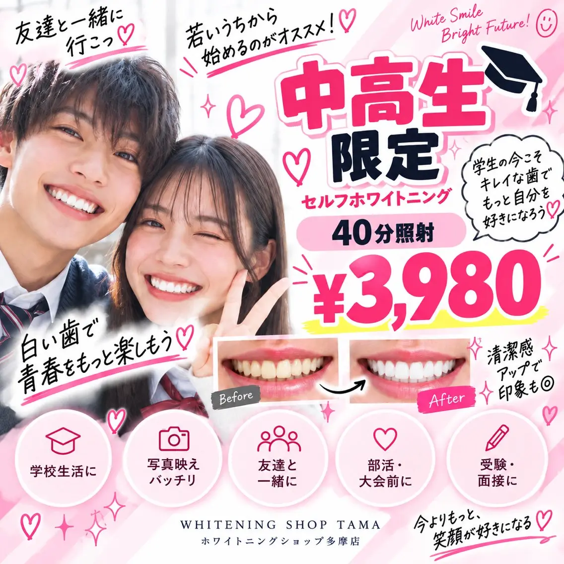 【🌸中高生限定🌸友達と一緒もOK♡40分セルフホワイトニング¥3,980✨】の写真