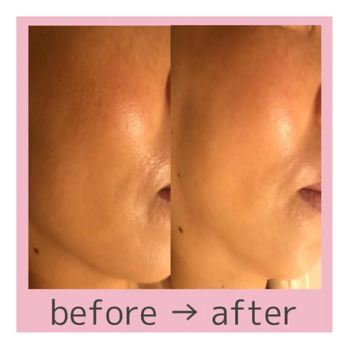 何度でも利用可🧸お顔集中🩷クイックエステ💆‍♀️の写真