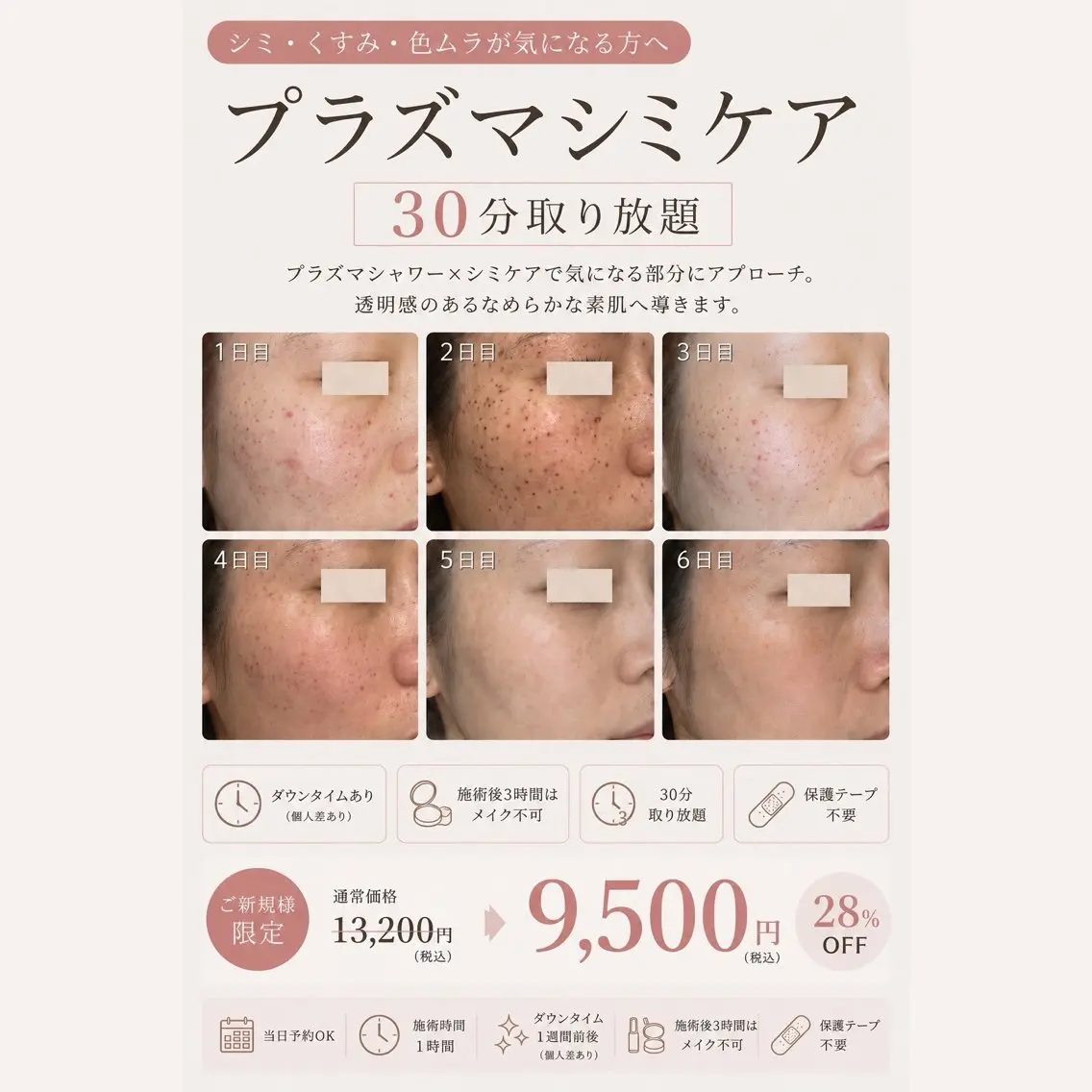 【新導入】プラズマシミケア30分取り放題（6/11​〜​予約開始）の写真