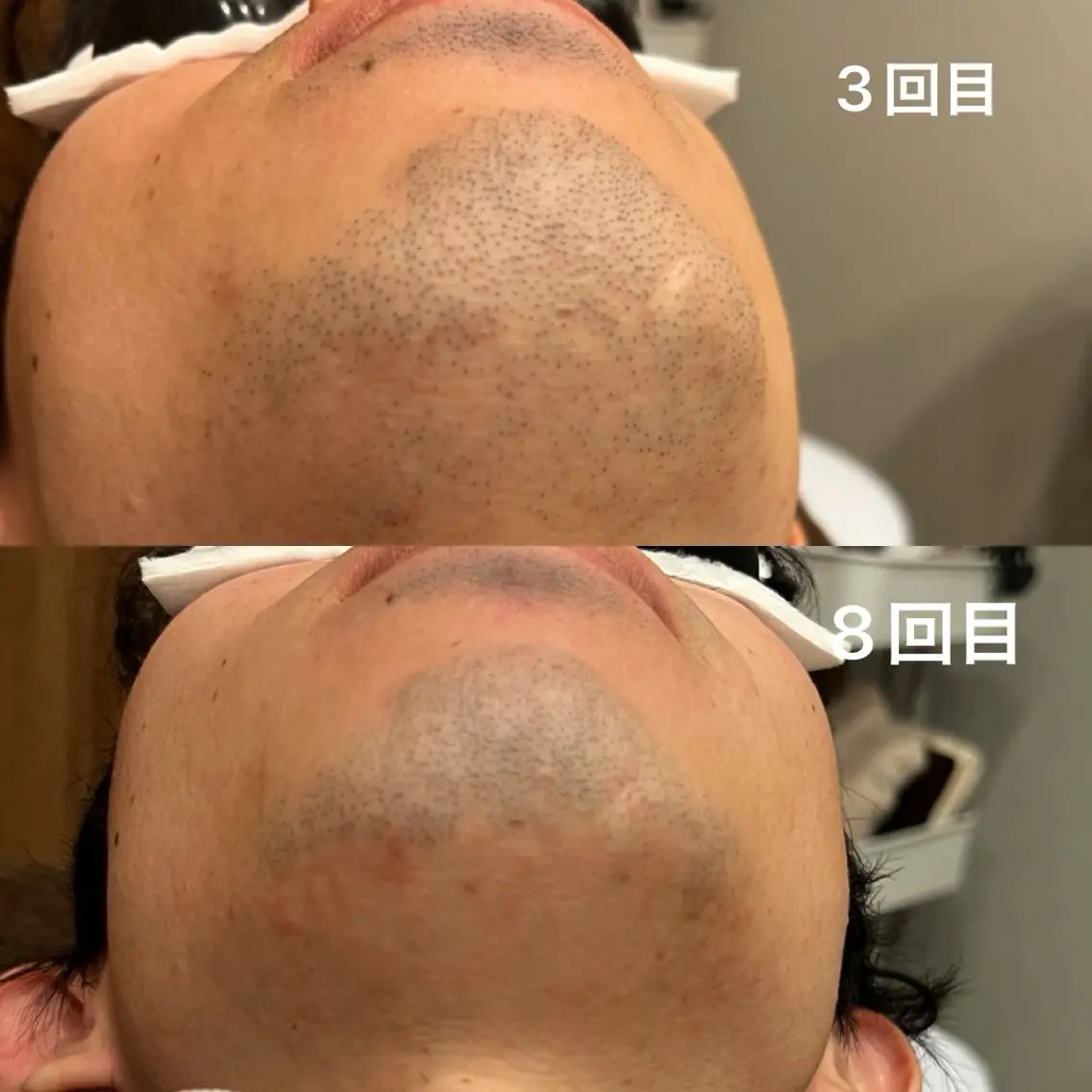 メンズ 脱毛 eyelash CHEMIRのエステ・リラクイメージ