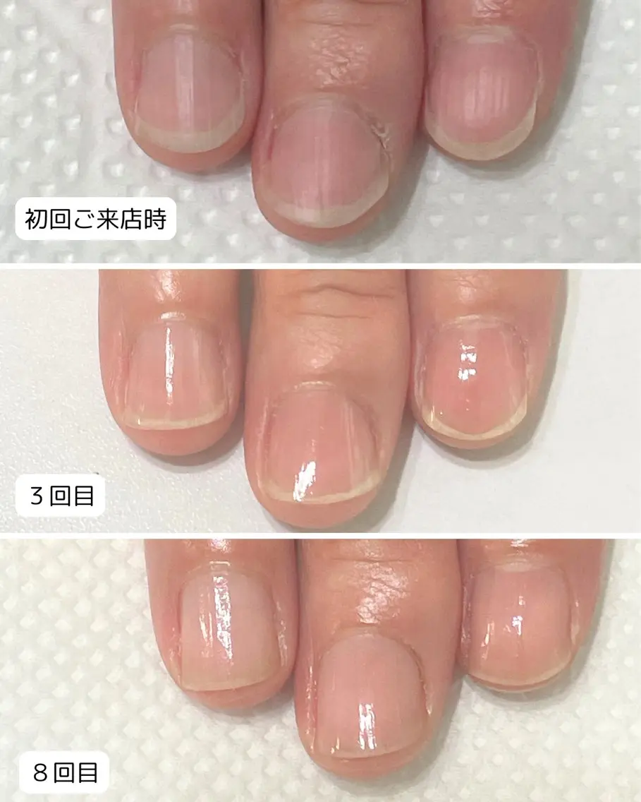 ネイル 自爪育成専門店 Kapilinaのネイルデザイン