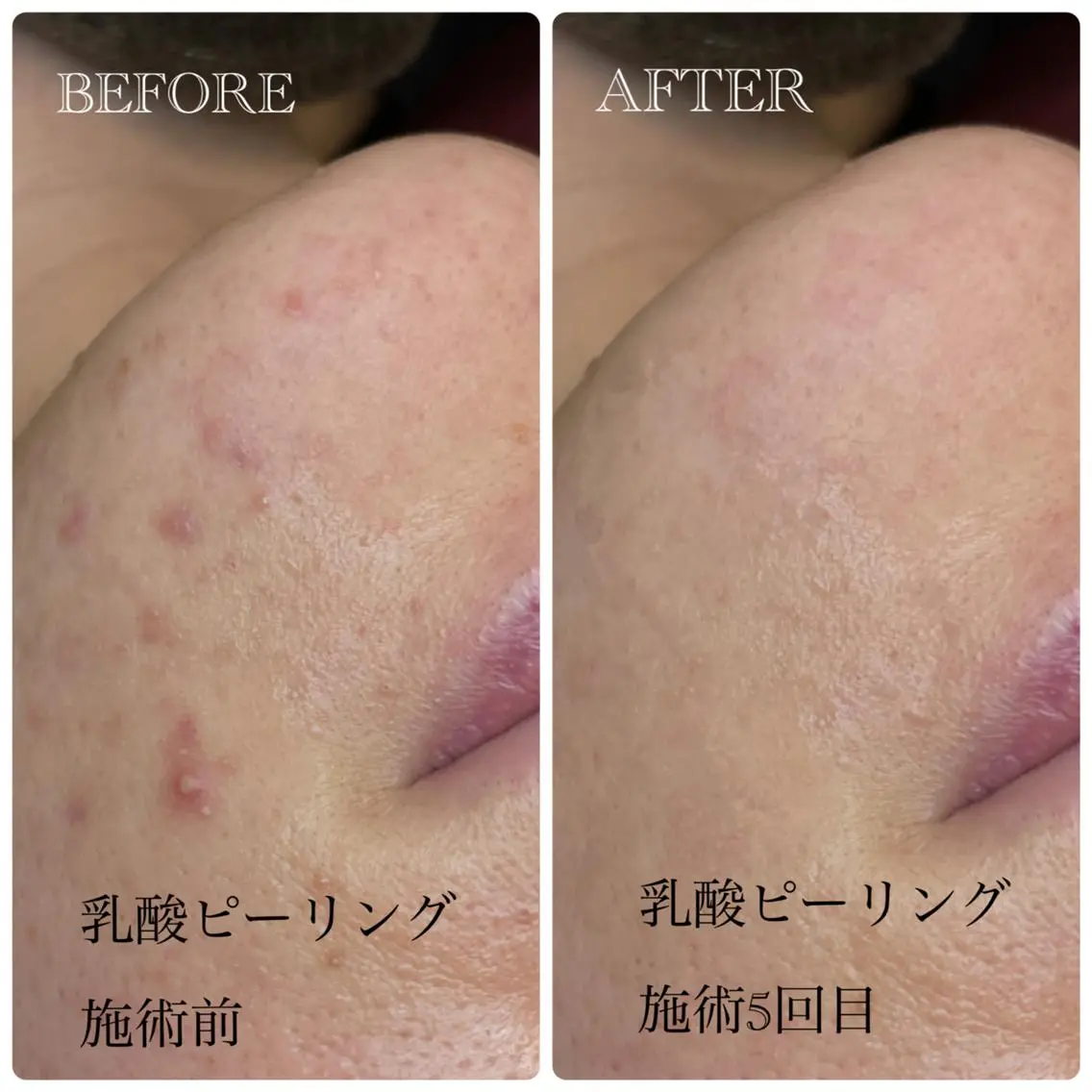 Crescent Beautyのエステ・リラクイメージ