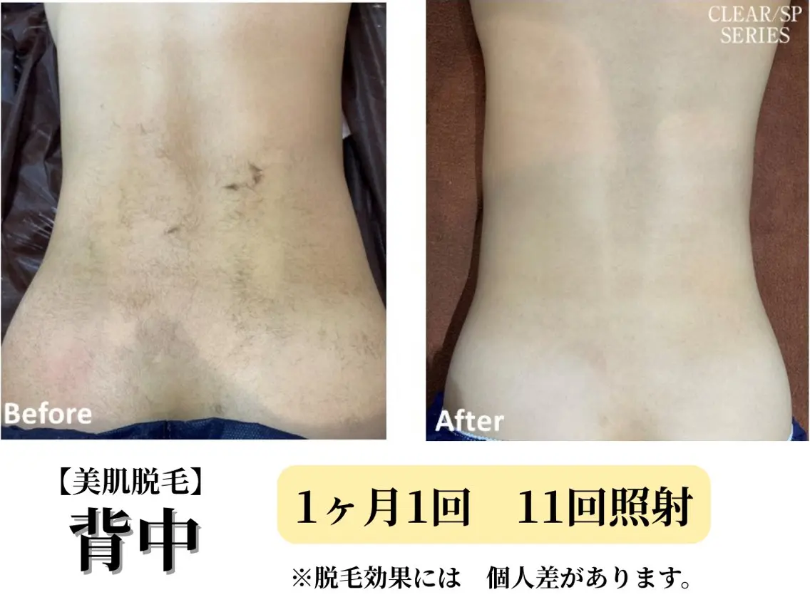 脱毛 本格痩身＊透明美肌 BelleWhiteのエステ・リラクイメージ