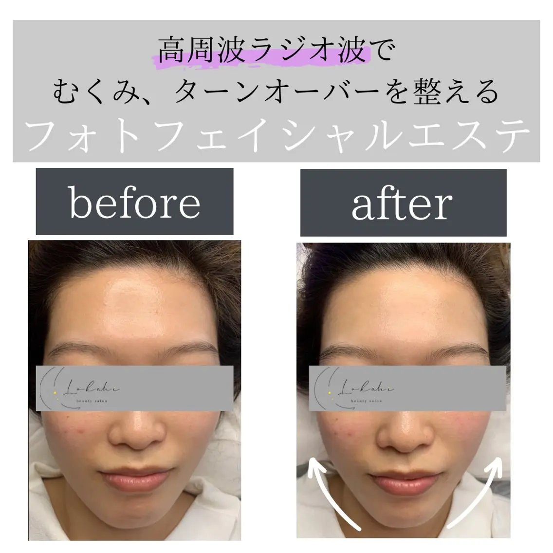 脱毛サロン Lokahiのエステ・リラクイメージ