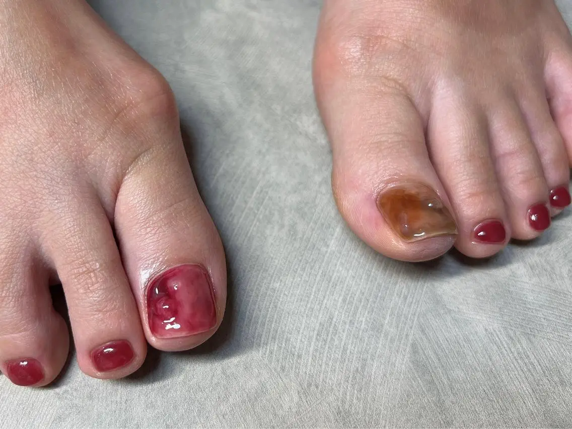 ネイル フットネイル Lavish nailのネイルデザイン