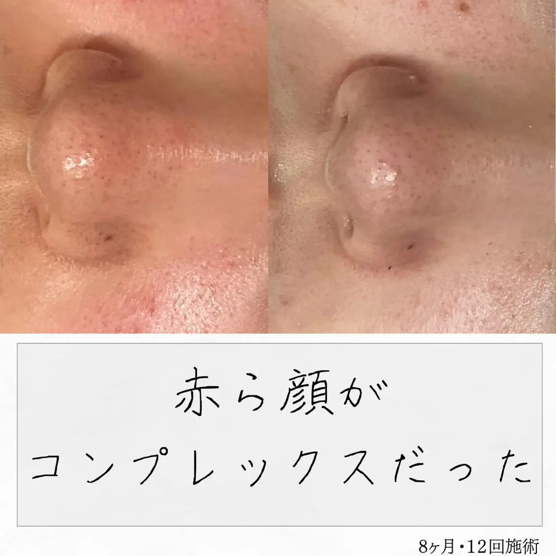 ニキビ経験者が施術 する専門サロン🌻のエステ・リラクイメージ