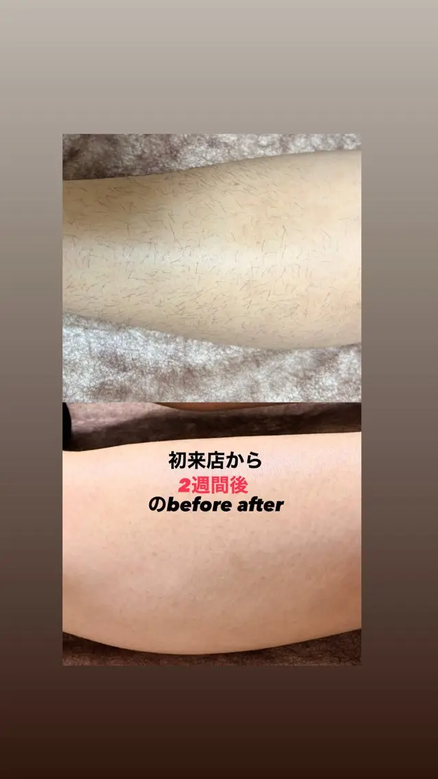 脱毛サロン moco selfのエステ・リラクイメージ