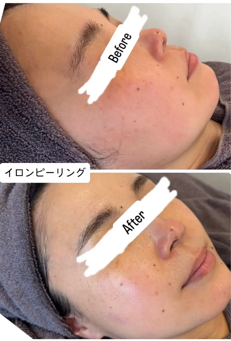 エステ 桐山 まどかのエステ・リラクイメージ