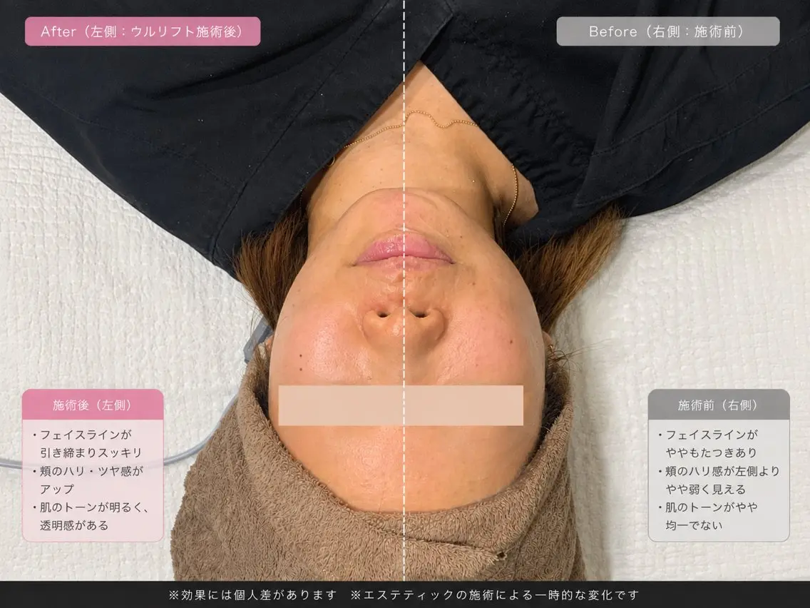 マツエク・マツパ エステ 愛維美水光美肌専門店 メンズレディースokのエステ・リラクイメージ