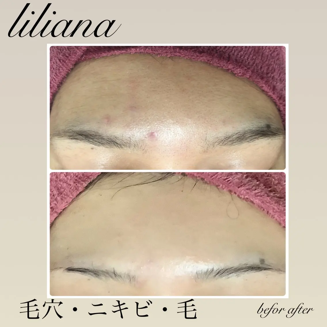 エステ リラク LILIANA ☆YURIのエステ・リラクイメージ